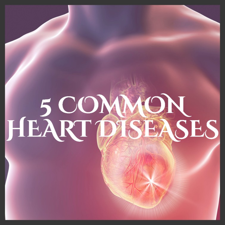 What are the 5 most Common Heart Problems